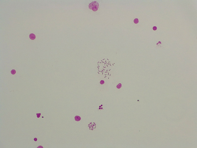 Male Chromosomes Slides - Male Chromosomes 05 100X